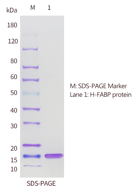 H-FABP抗原的SDS-PAGE分析圖 H-FABP抗原的SDS-PAGE分析圖